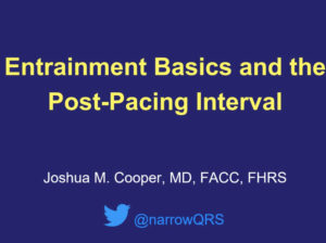 Entrainment Mapping: The Post-Pacing Interval