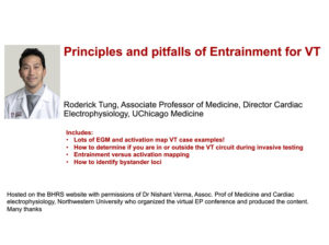Principles and Pitfalls of Entrainment for VT