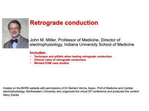 Retrograde Conduction