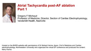 Atrial Tachycardia post-AF ablation: Part 1