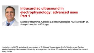 Intracardiac ultrasound in electrophysiology: advanced uses: Part 1