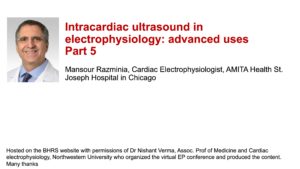 Intracardiac ultrasound in electrophysiology: advanced uses: Part 5