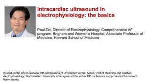 Intracardiac ultrasound in electrophysiology: the basics