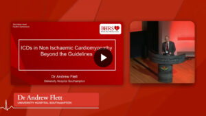 SESSION 1a:  Primary prevention ICDs in NICM, beyond the guidelines - Dr Andrew Flett