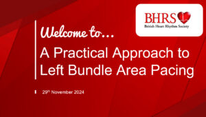 PREVIEW BHRS Webinar Recording: A Practical Approach to Left Bundle Area Pacing