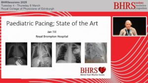 SESSIONS: Day 3 - Auditorium - Paediatric pacing – state of the art - Jan Till