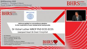 SESSIONS: Day 2 - Auditorium - An Update on Ripple AT - Vishal Luther