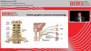 SESSIONS: Day 2 - Auditorium - Using local anaesthetic – stellate ganglion block for arrhythmia - Antonio Creta