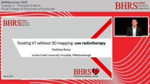SESSIONS: Day 2 - Auditorium - Treating VT without 3D Mapping: use radiotherapy - Matthew Bates