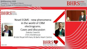 SESSIONS: Day 2 - Great Hall - Novel EGMS - new phenomena in the world of CRM electrograms. Cases and discussion - Dakota Creed & Chris Monkhouse
